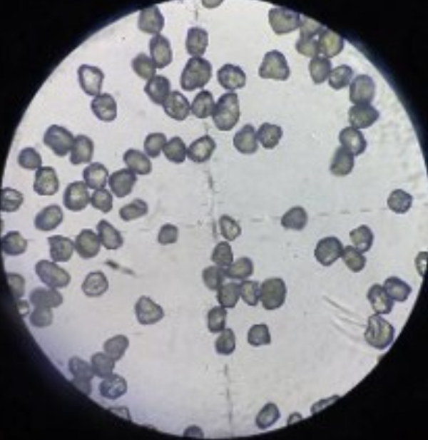 HTHP - Spherical Diamond